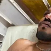 Escaped Man From Ahemdabad Flight Accident Told Reality. London Returning Man Story Shocked Everyone.